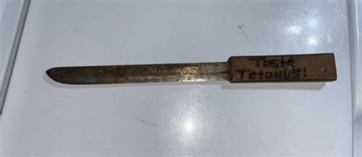 Can a kitchen knife give you tetanus?