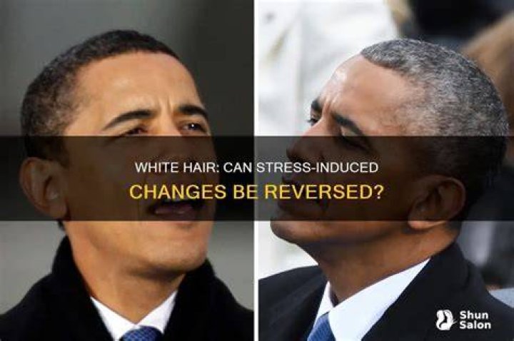 Can white hair due to stress be reversed?