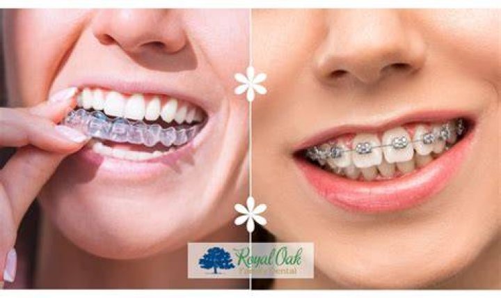 Do braces work faster when pregnant?