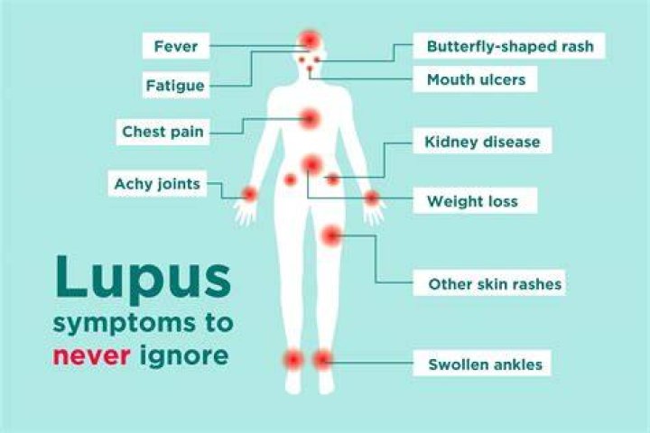 Does lupus cause itchy feet?