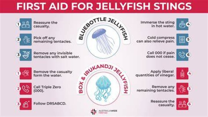 Does Pee help a jellyfish sting?