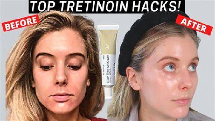 What should I put on after tretinoin?