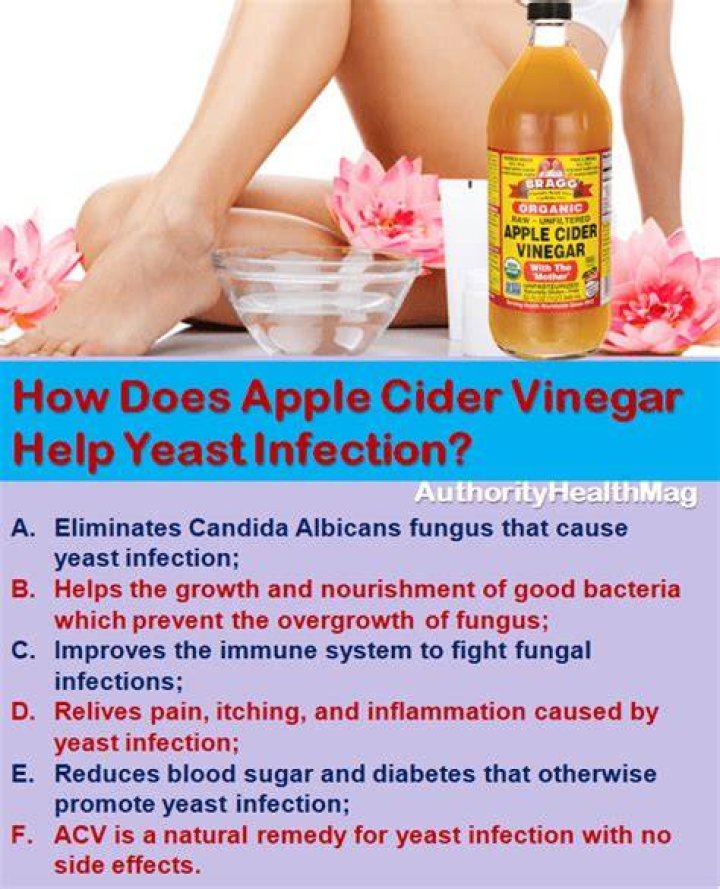 Will drinking apple cider vinegar help cure yeast infection?